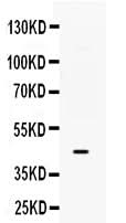 Anti-B3GNT8 Antibody Picoband® Boster Bio