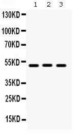 Anti-BMP5 Antibody Picoband® Boster Bio