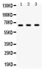 Anti-Chk2/CHEK2 Antibody Picoband® Boster Bio