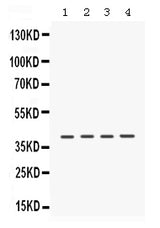 Anti-Caseine Kinase 1 alpha/CSNK1A1 Antibody Picoband® Boster Bio