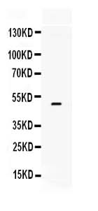 Anti-Tissue Factor/F3 Antibody Picoband® Boster Bio