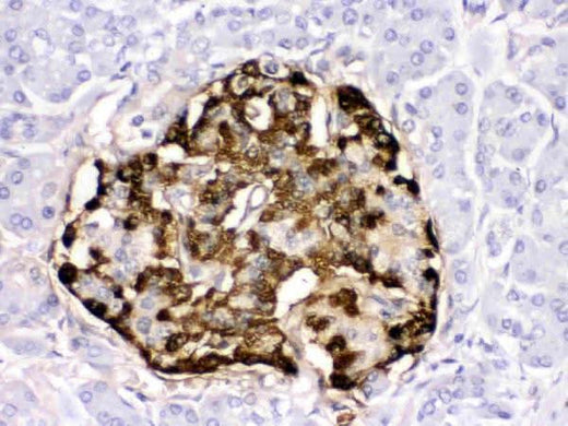 Anti-Glucagon/GCG Antibody Boster Bio