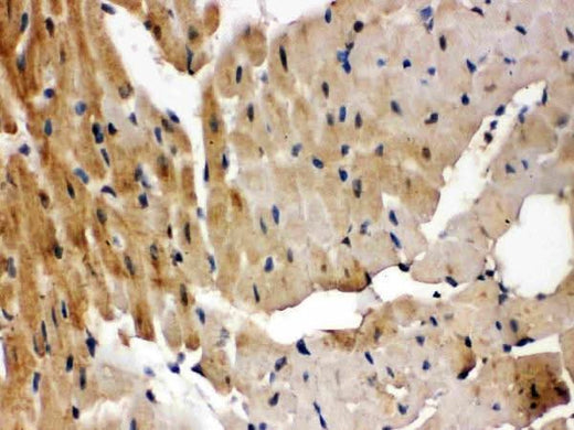 Anti-GRK5 Antibody Picoband® Boster Bio