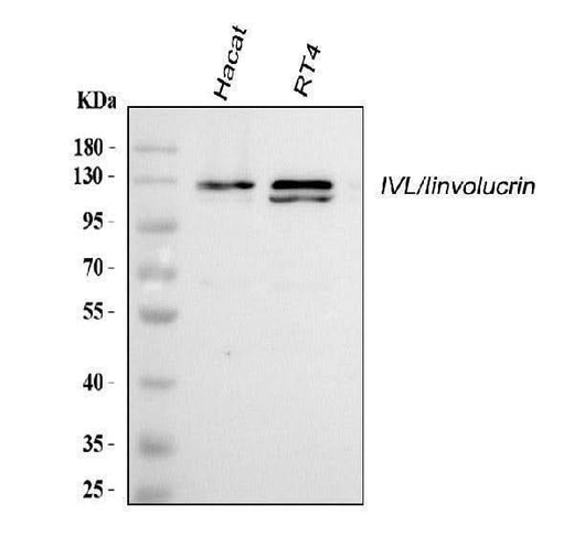 Anti-Involucrin/IVL Antibody Picoband® Boster Bio