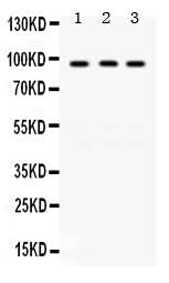 Anti-KAT2A/GCN5 Antibody Picoband® Boster Bio