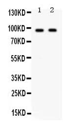 Anti-p90 Autoantigen/KIAA1524 CIP2A Antibody Picoband® Boster Bio