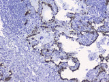 Anti-Cytokeratin 19/KRT19 Antibody Picoband® Boster Bio