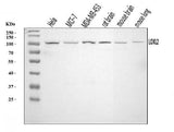 Anti-LOXL2 Antibody Picoband® Boster Bio