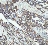 Anti-Microsomal Glutathione S-transferase 1/MGST1 Antibody Picoband® Boster Bio