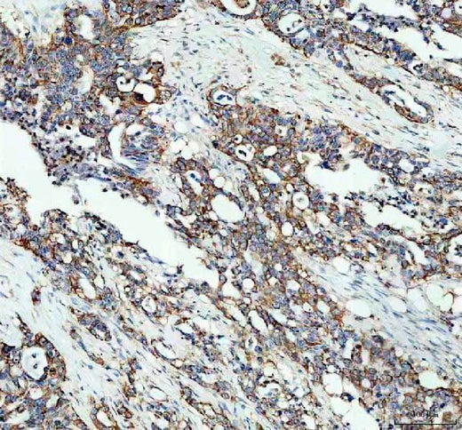 Anti-Microsomal Glutathione S-transferase 1/MGST1 Antibody Picoband® Boster Bio