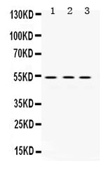 Anti-MMP1 Antibody Picoband® Boster Bio