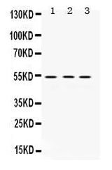 Anti-MMP1 Antibody Picoband® Boster Bio