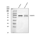 Anti-MMP8 Antibody Picoband® Boster Bio