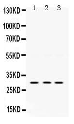 Anti-AMPK beta 2/PRKAB2 Antibody Picoband® Boster Bio