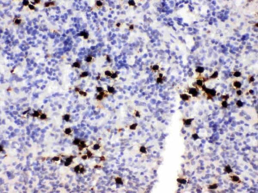Anti-MRP8/S100A8 Antibody Picoband® Boster Bio