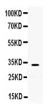 Anti-TREX1 Antibody Picoband® Boster Bio
