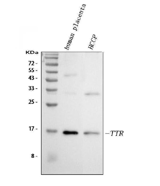 Anti-Prealbumin/TTR Antibody Picoband® Boster Bio