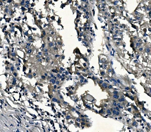 Anti-alpha 1d Adrenergic Receptor/ADRA1A Antibody Picoband® Boster Bio