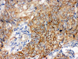 Anti-Bag3 Antibody Picoband® Boster Bio