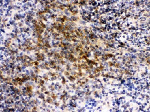 Anti-eIF4A2 Antibody Picoband® Boster Bio