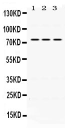 Anti-IL2 Receptor beta/IL2RB Antibody Picoband® Boster Bio