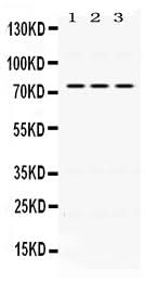 Anti-IL2 Receptor beta/IL2RB Antibody Picoband® Boster Bio