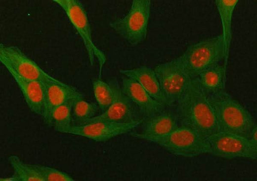 Anti-Mineralocorticoid Receptor/NR3C2 Antibody Picoband® Boster Bio