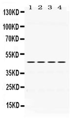 Anti-PAX6 Antibody Picoband® Boster Bio
