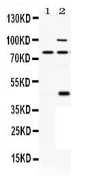 Anti-PACE4/PCSK6 Antibody Picoband® Boster Bio