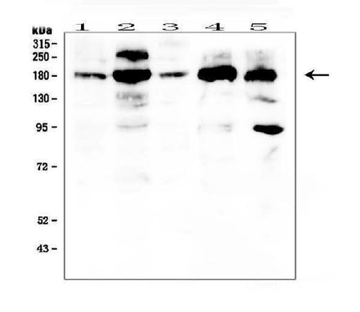 Anti-PDGF Receptor alpha/PDGFRA Antibody Picoband® Boster Bio