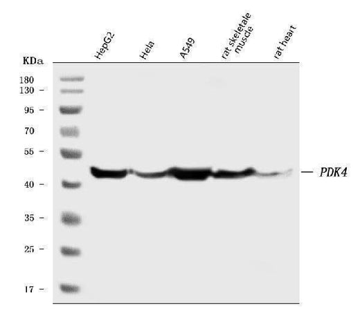 Anti-PDK4 Antibody Picoband® Boster Bio