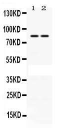 Anti-Phospholipase A2/PLA2G4A Antibody Picoband® Boster Bio