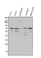 Anti-POT1 Antibody Picoband® Boster Bio