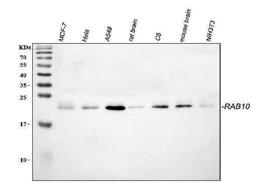 Anti-RAB10 Antibody Picoband® Boster Bio