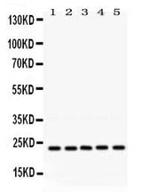 Anti-Rab18 Antibody Picoband® Boster Bio