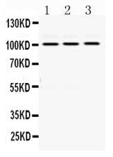 Anti-RASA1 Antibody Picoband® Boster Bio