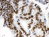 Anti-RbAp48/RBBP4 Antibody Picoband® Boster Bio
