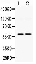Anti-DGAT1 Antibody Picoband® Boster Bio