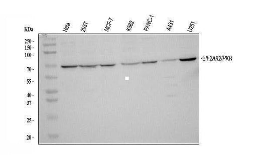 Anti-PKR/EIF2AK2 Antibody Picoband® Boster Bio