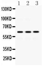 Anti-EME1 Antibody Picoband® Boster Bio