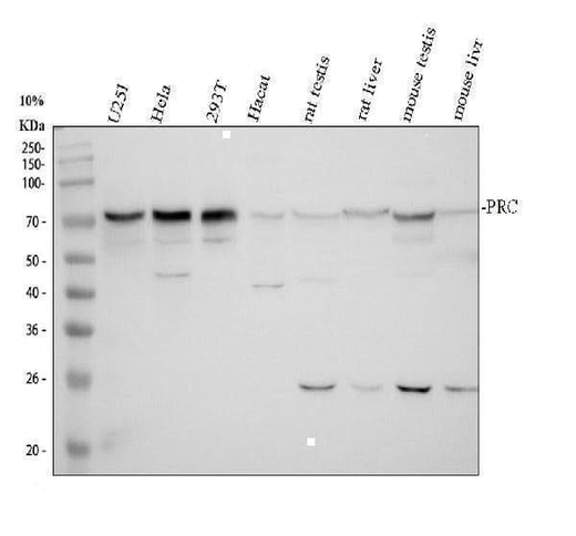 Anti-PRC1 Antibody Picoband® Boster Bio