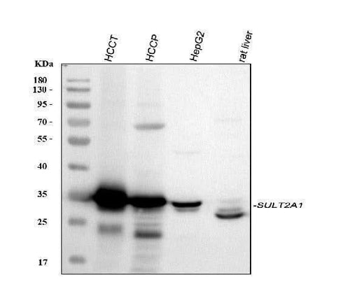 Anti-SULT2A1 Antibody Picoband® Boster Bio