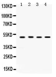 Anti-SULT2B1 Antibody Picoband® Boster Bio