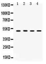 Anti-SULT2B1 Antibody Picoband® Boster Bio