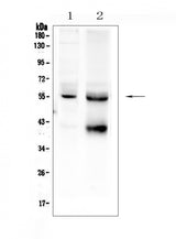 Anti-TGF beta Receptor I/TGFBR1 Antibody Picoband® Boster Bio