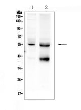 Anti-TGF beta Receptor I/TGFBR1 Antibody Picoband® Boster Bio