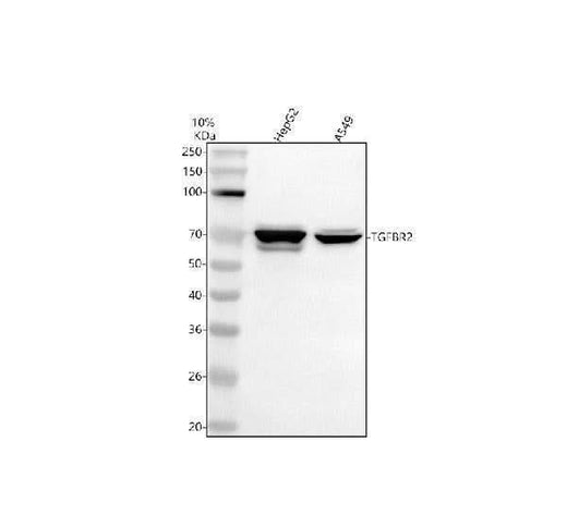 Anti-TGF beta Receptor II/TGFBR2 Antibody Picoband® Boster Bio