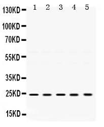 Anti-TIMP2 Antibody Picoband® Boster Bio