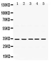 Anti-TIMP3 Antibody Picoband® Boster Bio