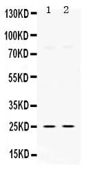 Anti-Thymidine Kinase 1/TK1 Antibody Picoband® Boster Bio
